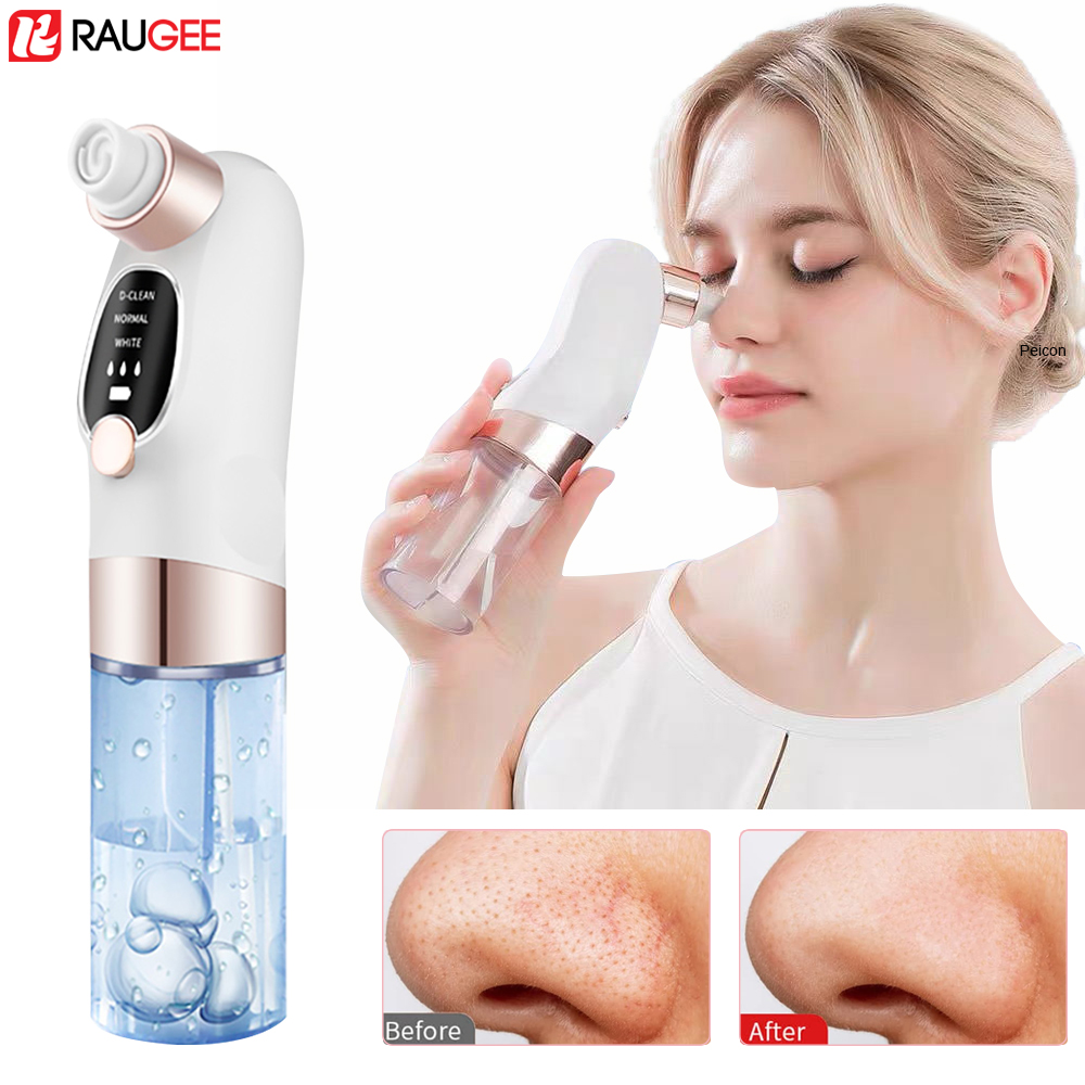 Blackhead Remover Electric Bla – Air Bubble Remover Bewertung und Preis